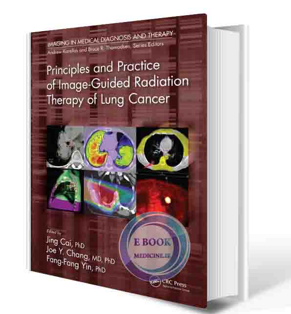 دانلود کتابPrinciples and Practice of Image-Guided Radiation Therapy of Lung Cancer (Imaging in Medical Diagnosis and Therapy) 2017 (ORIGINAL PDF)